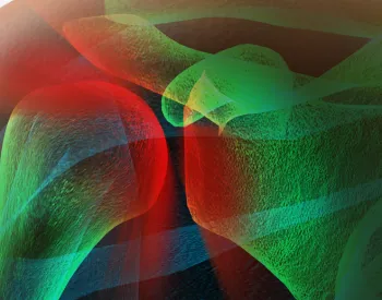 Preview image for Exercising With a Rotator Cuff Tear: What Works (And What to Avoid)
