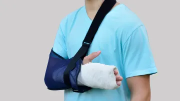 a person wearing a blue shirt and a cast