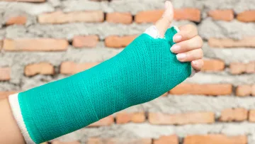 a person in a green cast