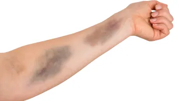 a close-up of a person's arm