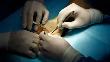 a person having surgery