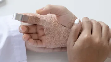 a hand in a splint