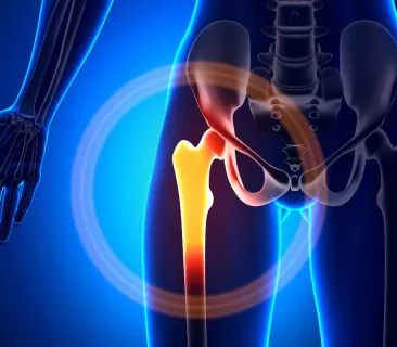 Image for 5 Clear Signs That You Need a Hip Joint Replacement