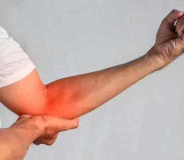 Image for Tennis Elbow vs. Golfer's Elbow: How to Tell the Difference