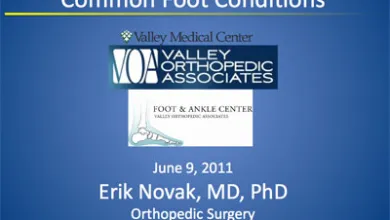 Common Foot Conditions