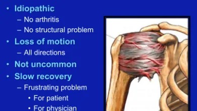 Painful Conditions of the Shoulder Presentation