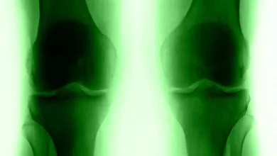 Shortening Joint Replacement Stays