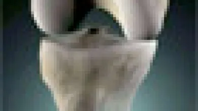 Joint Replacement Blog