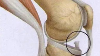 Common Knee Condition Presentation