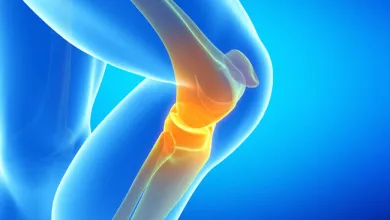 Does Robotic Guidance Improve Knee Replacement?