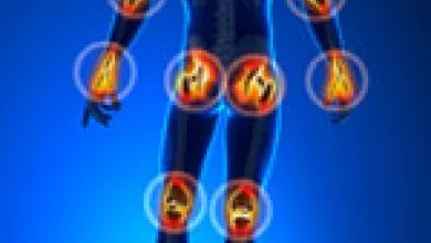 Dr. Barrett Talks Joint Replacement