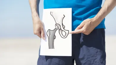 Person holding and pointing at a hip joint diagram illustrating hip replacement surgery.