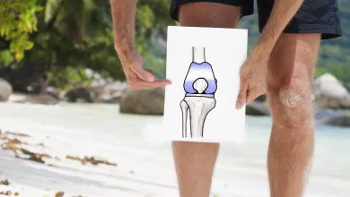 Person on beach holding illustration of knee joint highlighting cartilage areas in blue for anatomy focus