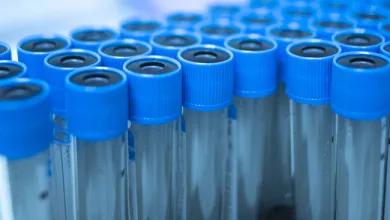 PRP Treatment For Osteoarthritis