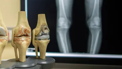 Dr. Barrett’s Blog: What’s new in Knee Replacement 2019