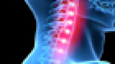 Learn About Cervical Disc Replacement