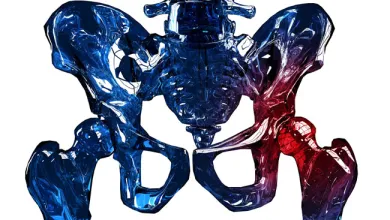 What’s New in Total Hip Arthroplasty?