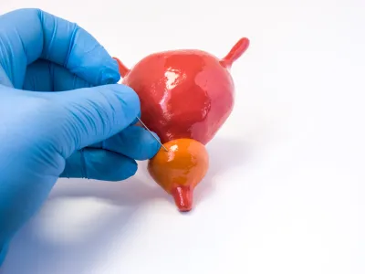 Gloved hand holding a medical probe near a model of a bladder and prostate on a white background