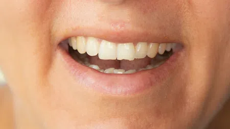 Close-up of a smiling mouth showing healthy white teeth and natural lips.