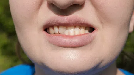 Close-up of a person's mouth showing clenched teeth and tense lips outdoors in natural light.