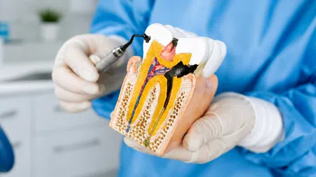 Dentist holding a tooth model showing dental pulp and root canals with a dental tool in clinic setting.