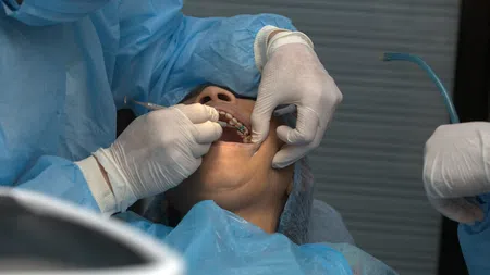 Dentist in protective gear performing dental procedure on patient lying in chair