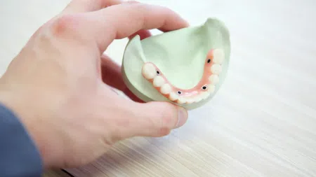 Hand holding a dental model showcasing lower jaw with artificial teeth and implants on a light wooden surface