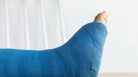Foot and lower leg wrapped in a blue medical cast with crutches in the background on a wooden surface.