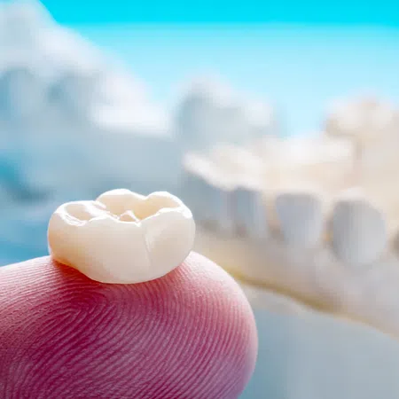 Close-up of a dental crown placed on a finger, showcasing its detail and craftsmanship against a blurred dental model.