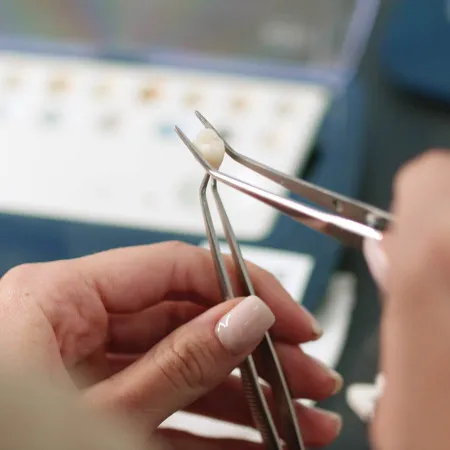 Close-up of hands holding dental restoration tools adjusting a tooth crown or dental prosthetic.