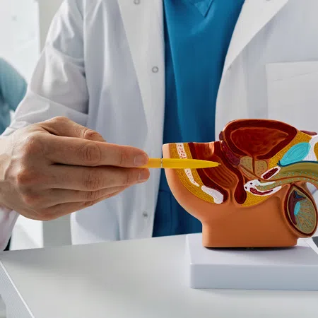 Doctor explains prostate anatomy with model while patient listens during medical consultation.