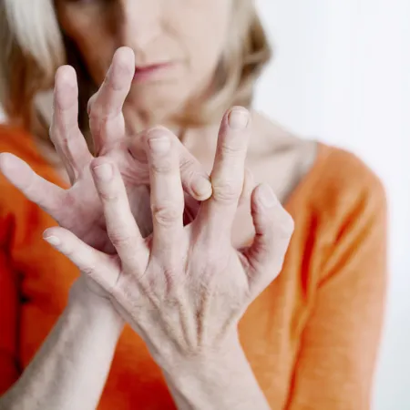 Difference Between Osteoarthritis and Rheumatoid Arthritis
