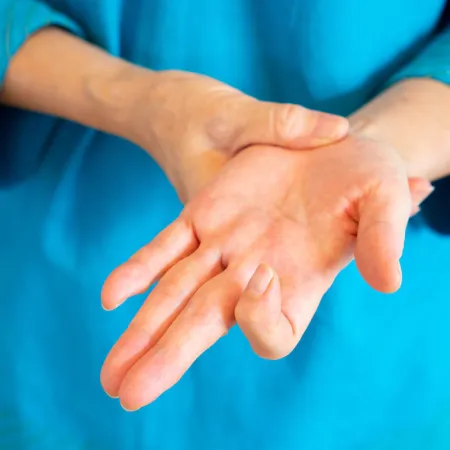 How To Treat Trigger Finger