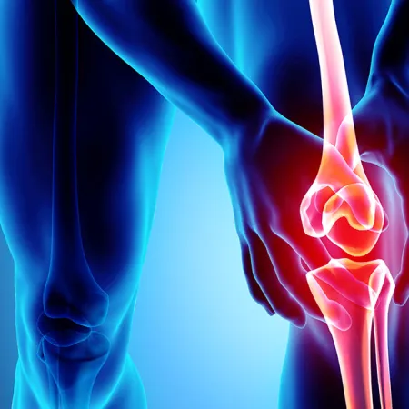4 Keys to Knee Replacement Recovery