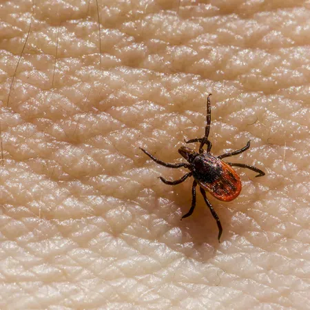 Close-up of a black and red minnesota tick crawling on textured human skin with hair strands visible.
