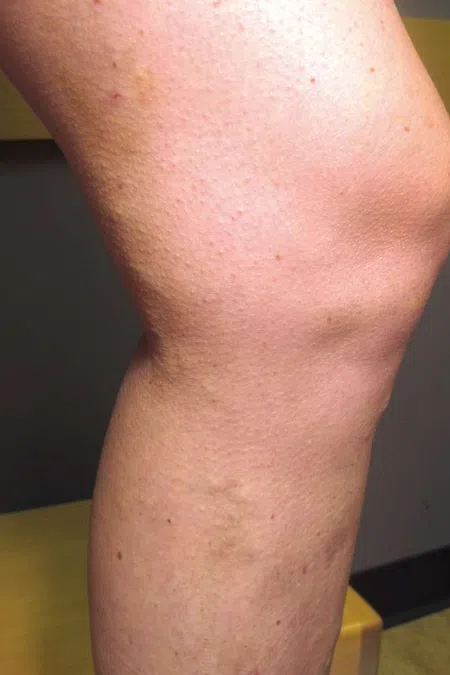 Close-up of a bent human knee showing natural skin texture and pores under warm lighting.