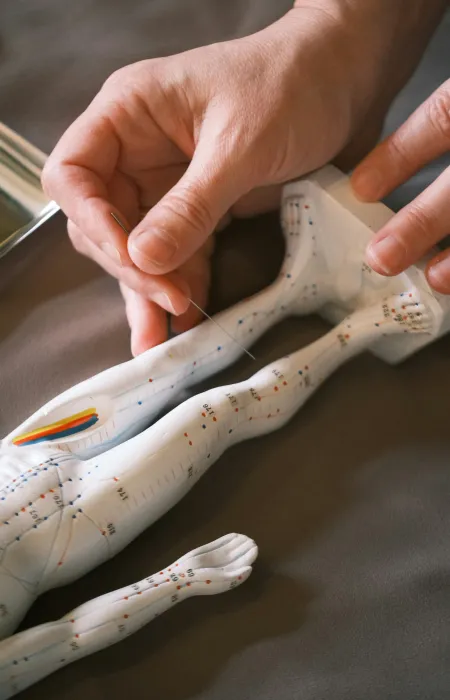 Hands holding an acupuncture needle above a model marked with acupuncture points on a human body figure.
