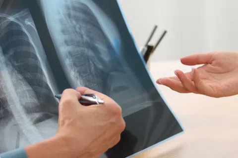 Doctor reviewing and explaining chest X-ray results to patient during medical consultation.