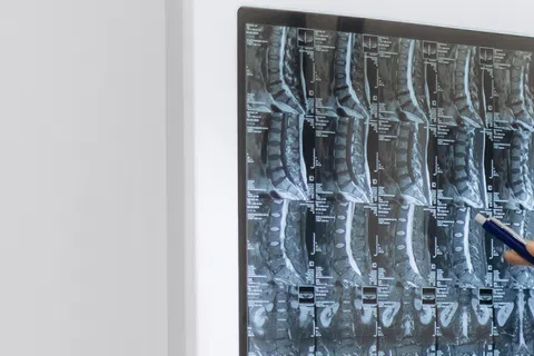 Doctor pointing at spinal X-ray images displayed on a lightbox in a medical office setting.