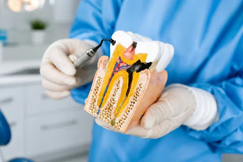 Dentist holding a detailed tooth model showing root canal anatomy and disease in a dental clinic.