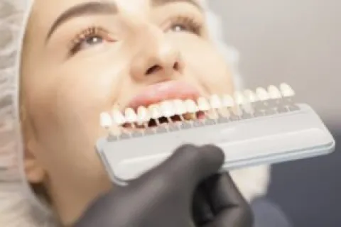 FAQS ABOUT FULL-MOUTH DENTAL IMPLANTS