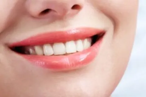 IS YOUR SMILE PHOTO-READY? TALK TO YOUR DENTIST ABOUT TOOTH WHITENING