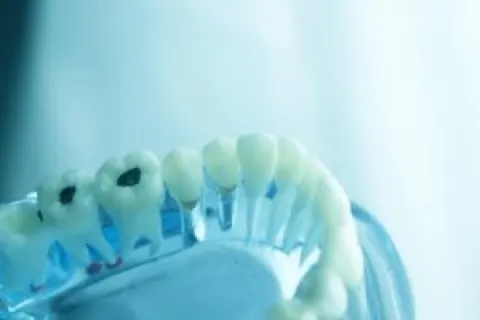 WHAT YOU CAN DO TO PREVENT PLAQUE BUILDUP