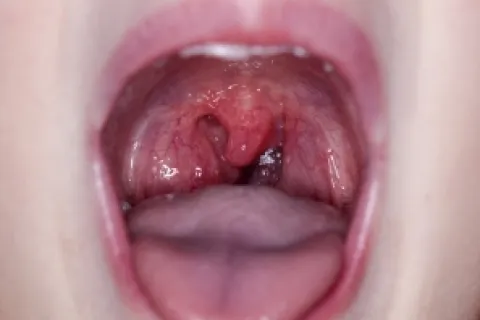 WHEN TO CALL YOUR DENTIST AFTER HOURS ABOUT TOOTH PAIN