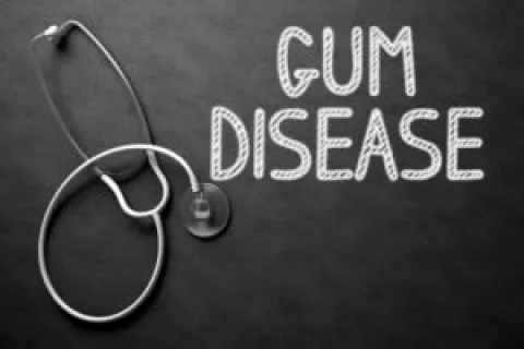 GUM DISEASE: REDUCING YOUR RISK