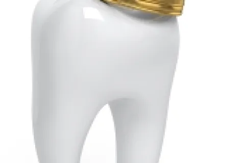 ALL ABOUT DENTAL CROWNS