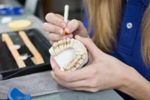 PORCELAIN ONLAYS 101