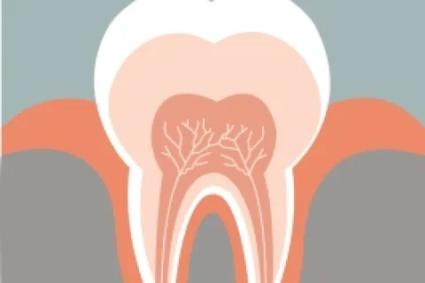 WHAT ARE PORCELAIN ONLAYS?