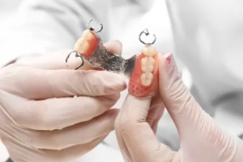 UNDERSTANDING FIXED DENTAL BRIDGES