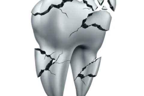 FAQS ABOUT DENTAL EMERGENCIES